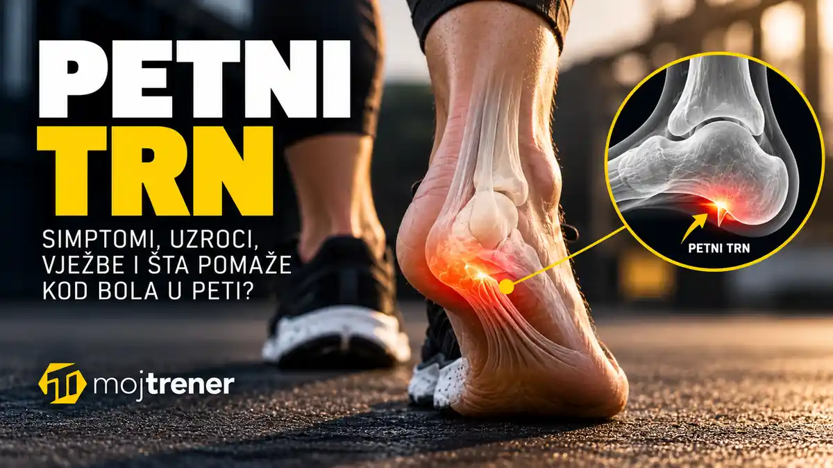 Petni trn - simptomi, uzroci, vježbe i šta pomaže kod bola u peti?